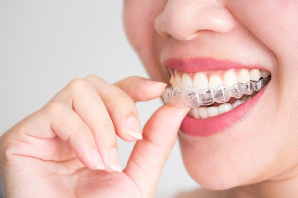 Ortodoncia Invisible Invisalign Torrevieja | De la Torre Clínica Dental