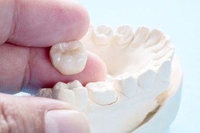Зубные коронки в Торревьехе | Стоматологическая клиника Де ла Торре