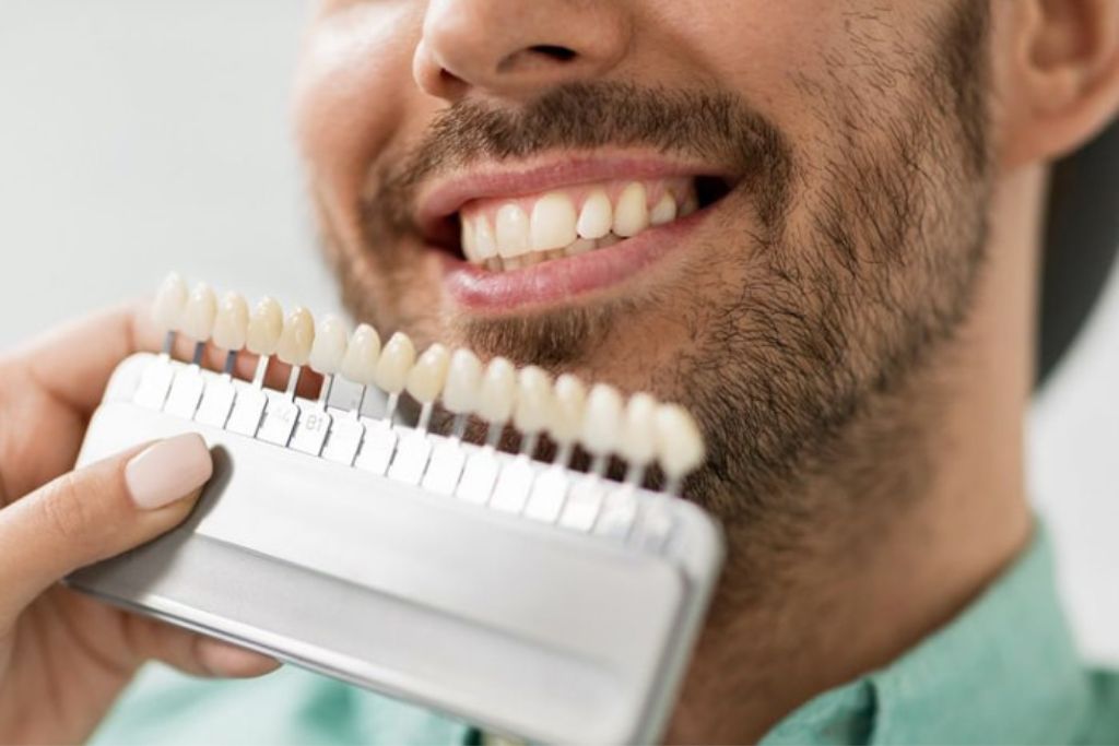 Dental Estetik - Torrevieja | De la Torre tandvårdsklinik