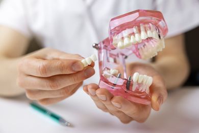 Зубні імплантати в Торрев'єха | Стоматологічна клініка De la Torre