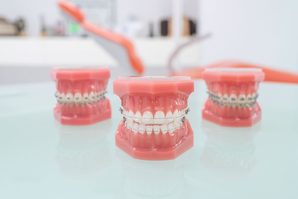 Orthodontie Torrevieja | Toren tandheelkundige kliniek