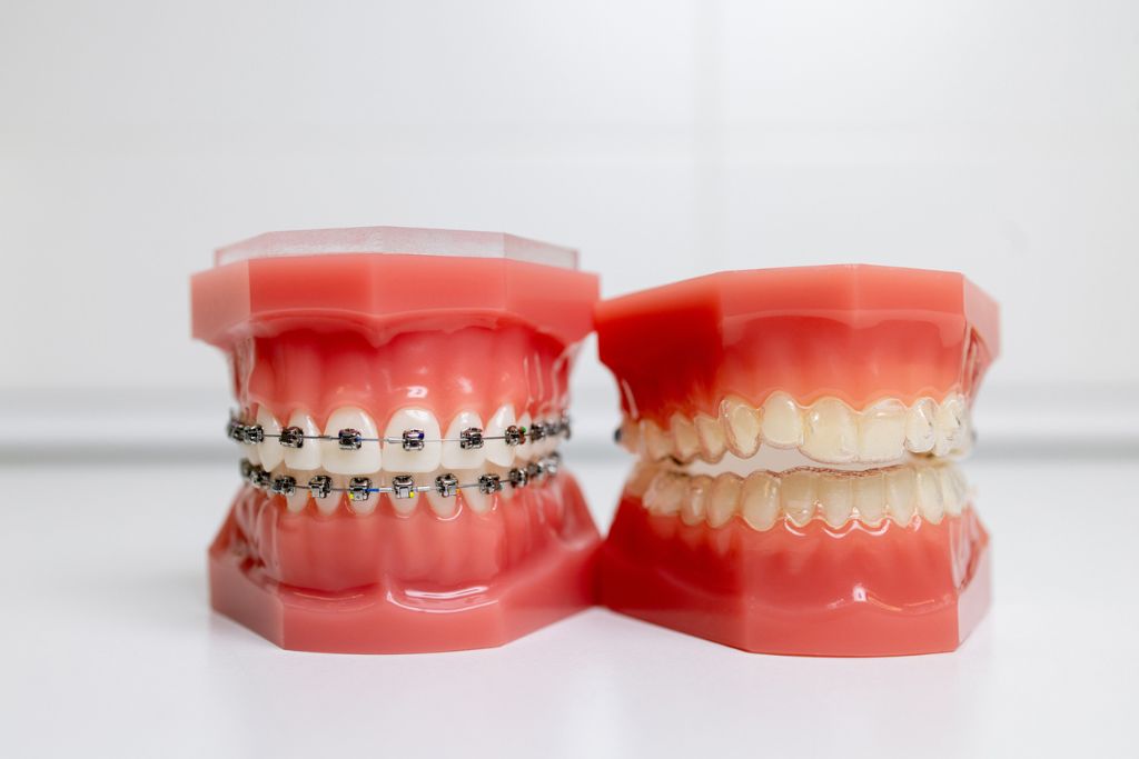 Ortodonti Torrevieja | De la Torre tandvårdsklinik