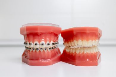 Ortodonti Torrevieja | De la Torre tandvårdsklinik